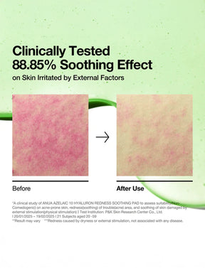 Azelaic 10 Hyaluron Redness Soothing Pad